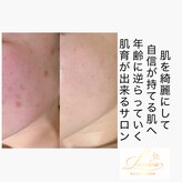 ラウレア(Laule’a)