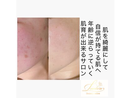 ラウレア(Laule’a)の写真