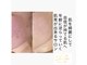 ラウレア(Laule’a)の写真