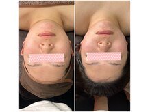オーラ(AURA)の雰囲気（本気のたるみケア！短期間での効果出しに自信◎岐阜・西岐阜）