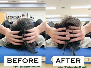 ビハリスト 麻布十番/頭のサイズからしっかり小顔に♪