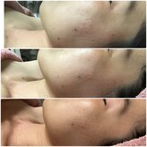 トータルビューティサロン リボーテ(Re:Beaute)