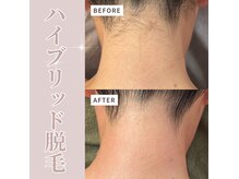 ベル(Belle)の雰囲気（肌見せの季節！夏はもうすぐ！お得に脱毛しませんか？★）