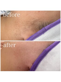 ジョワ アイラッシュサロン(joie)/マリムーブフェイシャルワックス