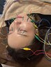1番人気！【美容鍼+身体ケア　100分】