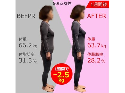 ダゼロ(DaZero)の写真