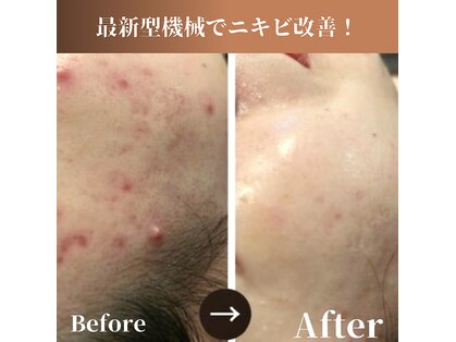 ベルダ(BELDAD)の写真