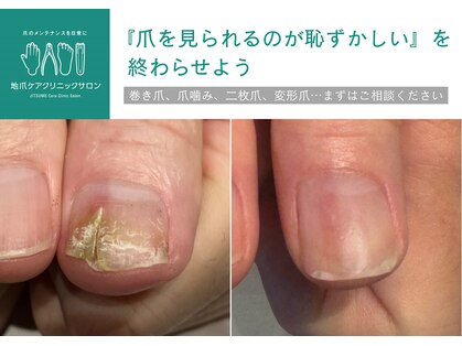 地爪ケアクリニックサロン 代々木店の写真