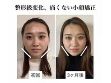 ラボーテヴェリテ(La Beaute Verite)の雰囲気（県外からもご来店多数！気持ちいいのに変わる！リフト小顔矯正　）