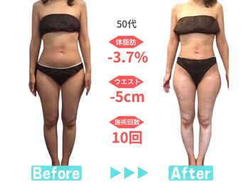 ビースタイル 一宮店(B'style)/50代マイナス5センチ