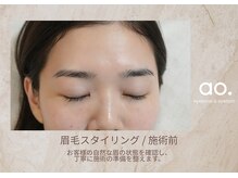アオ おもろまち(ao.)/～眉毛スタイリング 施術前～