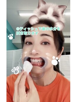 ホワイトニングビューティー 名古屋栄店(WHITENING BEAUTY)/セルフホワイトニング