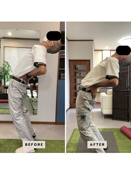 リポスト(RE:POST)/施術効果