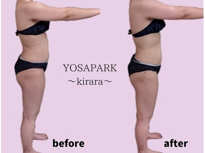 ヨサパーク キララ(YOSA PARK kirara)の写真
