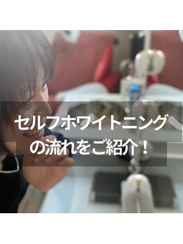 ホワイトニング ビューティー 南魚沼店(whitening beauty)/セルフホワイトニングの流れ