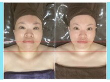 千歳の女神 岡崎店/【施術風景】Before/After