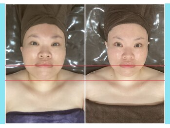 千歳の女神 岡崎店/【施術風景】Before/After