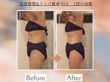 シェルシア(Cielcia)/全身筋膜＆リンパ痩身90分