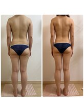 加圧ビューティーサロン スタイル エム(beauty salon style M)/20代/発汗スリミングリンパ120分