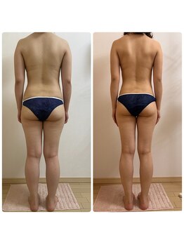 加圧ビューティーサロン スタイル エム(beauty salon style M)/20代/発汗スリミングリンパ120分