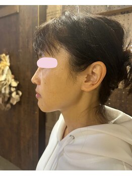 ナギスポット(Nagispot)/Before