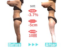 ビースタイル 一宮店(B'style)/50代マイナス5センチ