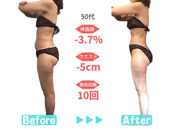 ビースタイル 一宮店(B'style)/50代マイナス5センチ