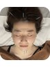 【たるみ/くすみ改善】全身調整鍼灸+美容鍼(60分)7000円→6000円/美肌/小顔/
