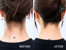 ミース 広島中央店の雰囲気(《うなじビフォーアフター》シェービングから脱毛まで対応)