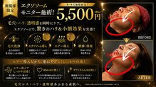 アンテグラール