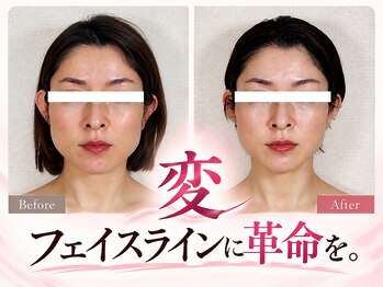 真美(Sinbi)の写真/他店で効果を感じられなかった方必見！写真でわかる圧倒的変化◎半年後の無料メンテナンス＆セルフケア付