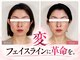 真美(Sinbi)の写真/他店で効果を感じられなかった方必見！写真でわかる圧倒的変化◎半年後の無料メンテナンス＆セルフケア付