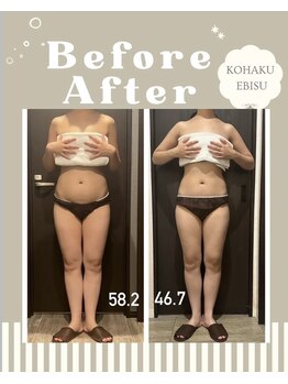 コハク エビス(KOHAKU EBISU)/本気で痩せたい方はKOHAKUへ