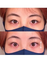 アルティ バイ ドルチェ(Ulti by dolce)/目をぱっちりしたい方必見！