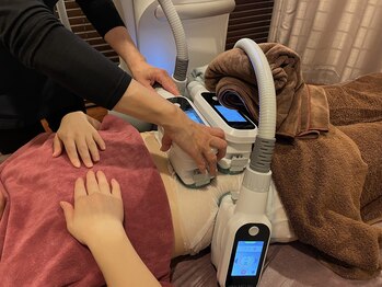 ユー(U)/脂肪冷却施術
