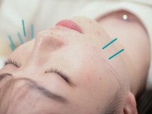 エアーストリーム 前橋店(AIR STREAM)/鍼で自律神経も整う☆