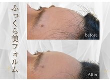 ソナ 大和西大寺院(SONA)/