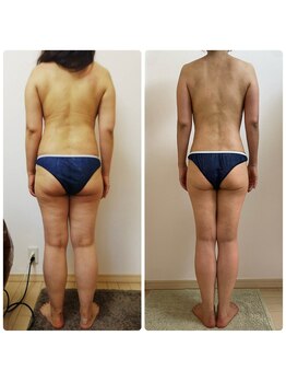 加圧ビューティーサロン スタイル エム(beauty salon style M)/50代/加圧×パワーツリー120分