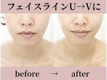 ガーデン(Garden)の雰囲気(【たるみケア】今さら/もう遅いのご不安解消します!)