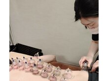 オードヴィー整骨院/背中カッピング