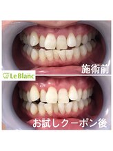 ルブラン 奈良店(Le Blanc)/先日お試しをご利用下さいました