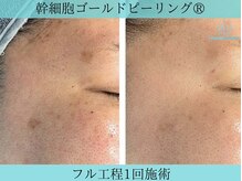 リメイククリニカルビューティー(Remake clinical beauty)/一回でも