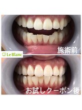 ルブラン 奈良店(Le Blanc)/15分2回！！1980円！！