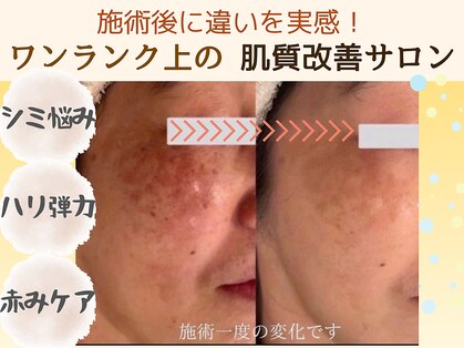 エラフリーの写真