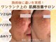 エラフリーの写真