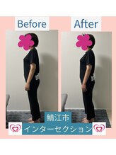腰の整体インターセクション/美容整体