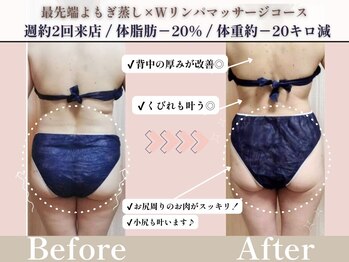 ヨサパーク プラーナ 千歳烏山店(YOSA PARK)/ビフォーアフター