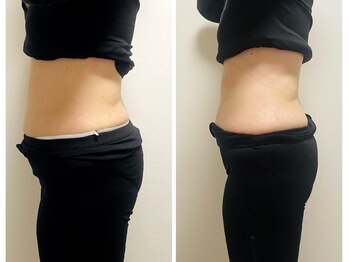 YOSAPARK Lulua/before*after