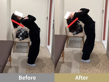 せなかのはね 井尻店/20代　肩こり　背中の張り　猫背