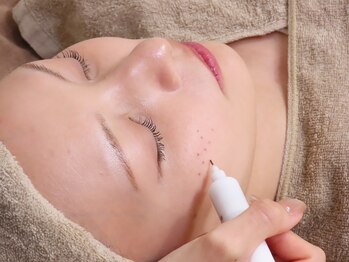 ロータス 千早香椎店(Lotus.)の写真/【効果がなければ意味がない、本気の悩みワンランク上の専門ケア】お化粧いらずのお肌に☆初回￥8500